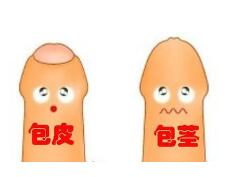 昭通包茎的男性为何一定要做手术