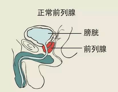 前列腺增生如何治疗有效