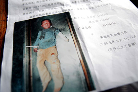 深圳发现湿疣疱疹被摘男童尸体(组图)