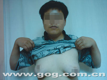 贵州男子10年疯长丰满性功能障碍 5个女友都告吹(图)