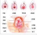 龟头炎是怎么回事