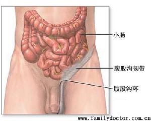 湿疣疱疹 湿疣疱疹