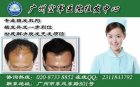 脱发严重是为什么产品的资料