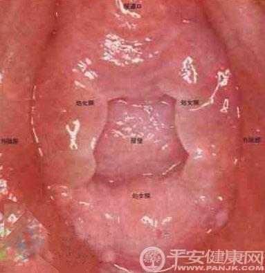 龟头炎图片