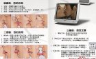 最全睾丸炎图解(转帖）